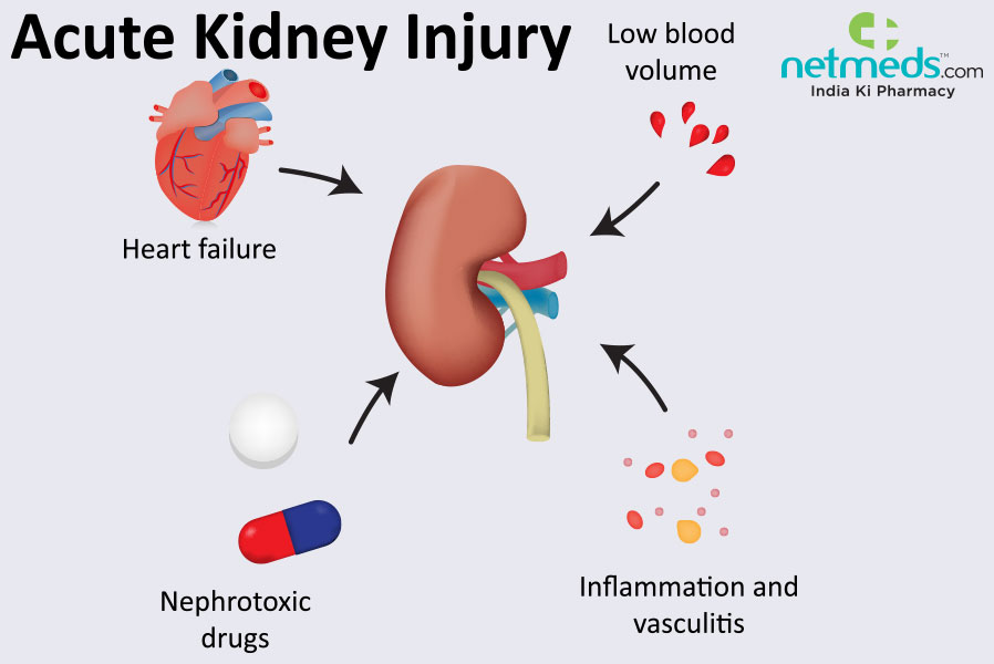Nephrology19's tweet photo. #Predicting outcomes of #acute #kidney #injury in critically ill #patients using #machine learning
Read more: https://t.co/uvGFgN6Z2G
share your paper on: https://t.co/NYhKfIhUa8
#oain
#Manuscript 
#research 
#acute #kidney
#Japan https://t.co/LLNBby30sZ