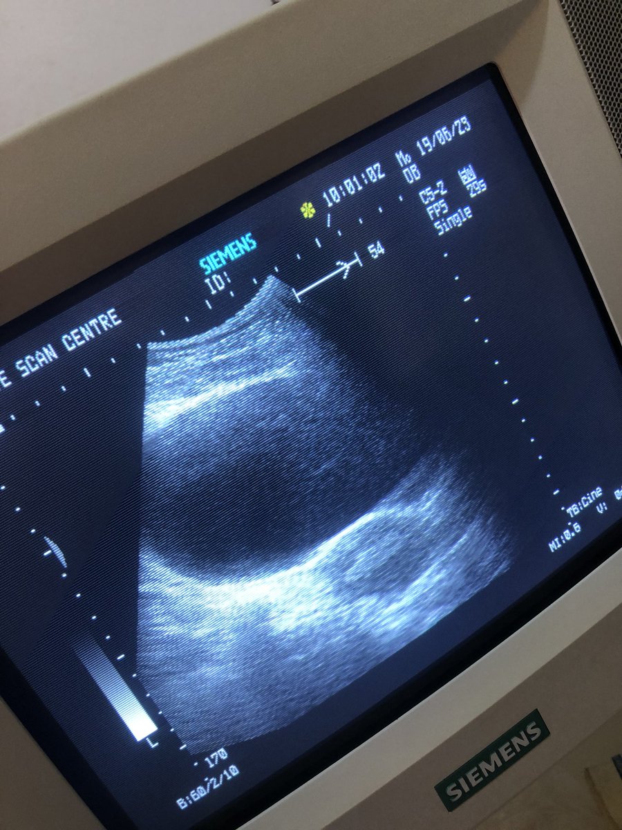 🚨28year old lady presented with pelvic pain, back pain & pain during sexual intercourse, two months after losing a pregnancy.

Ultrasound indicate Endometritis.

Endometritis? Yes, can lead to infertility..A thread🧵

Frame: Bacteria growth from Endocervical swab & pelvic scan.