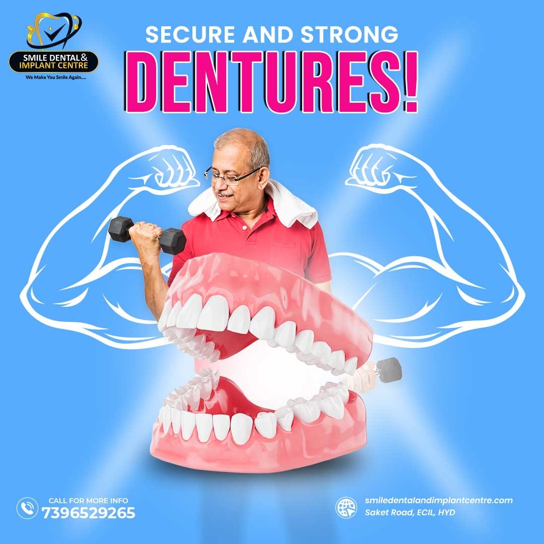 Secure #Dentures with the help of #SmileDentalandImplantCentre so you can live your life with confidence. Book a call now +91-7396529265.
EMI Available on all #DentalTreatments.
More Info Visit : smiledentalandimplantcentre.com
Location: #Ecil, #Hyderabad
 g.co/kgs/n3HqwW