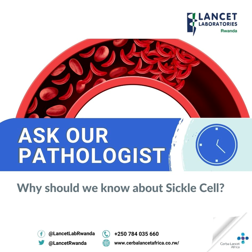 Lancet Laboratories Rwanda on Twitter "🔍Did you know that sickle cell