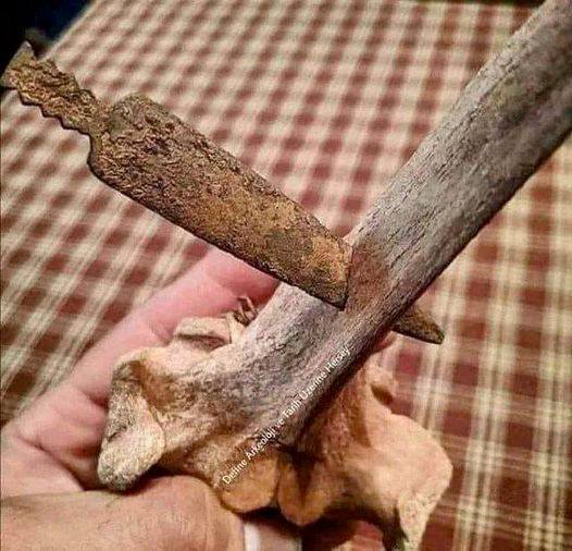 This is how the head of a spear went through a bone during the Roman Gaelic War. It still remains in the bone after 2070 years.