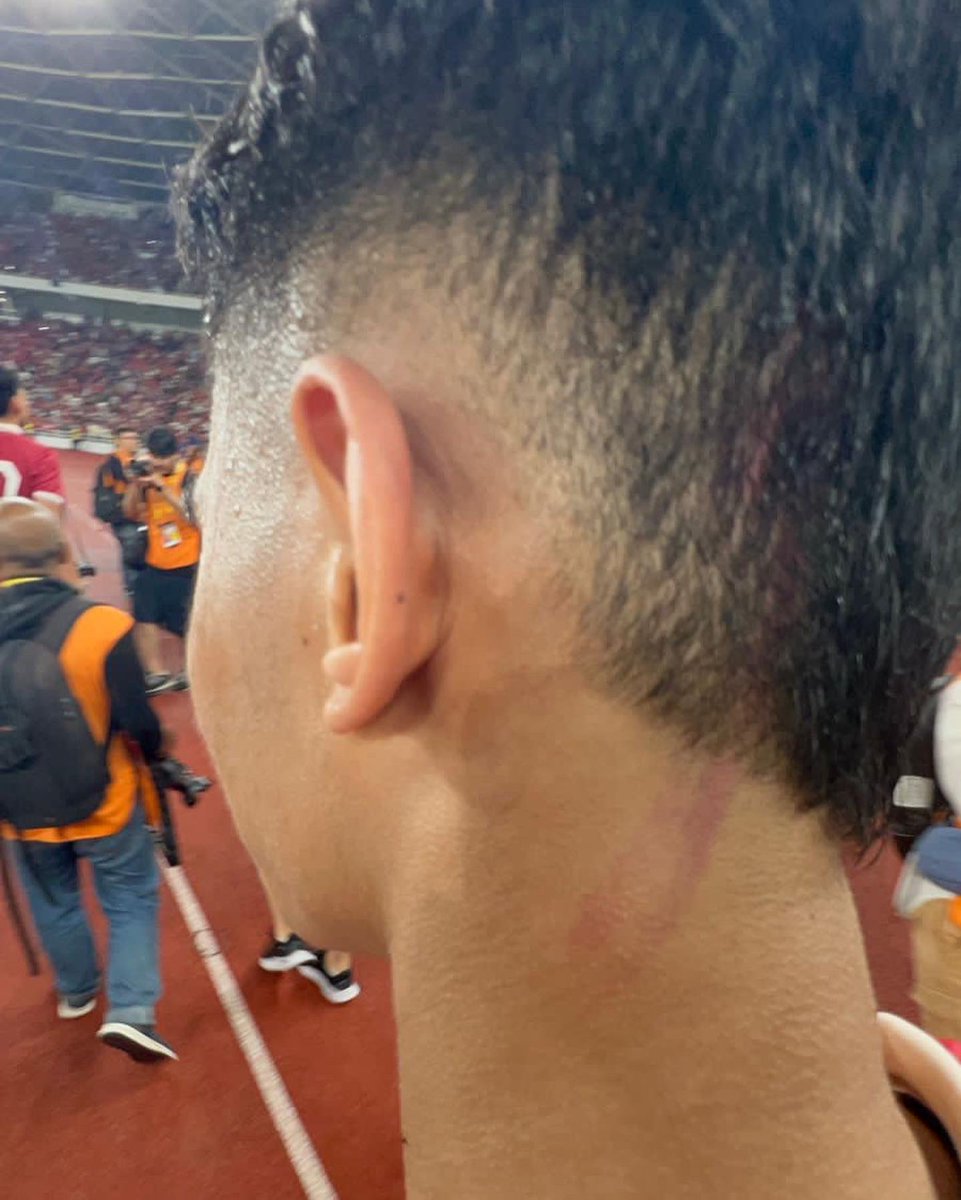 romero tak enteni pertigaan sememi broo