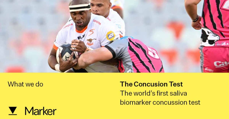 Test4Concussion's tweet photo. Saturday’s @TheCurrieCup final between @CheetahsRugby and #AirlinkPumas will complete this phase of our concussion collaboration with @Springboks, @WorldRugby. 

To find out more, click below 👇

#concussion #playerwelfare