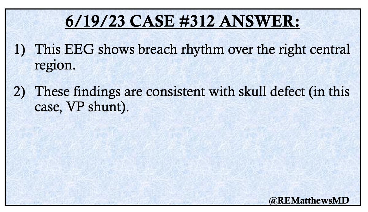 Rebecca E. Matthews, MD tweet media