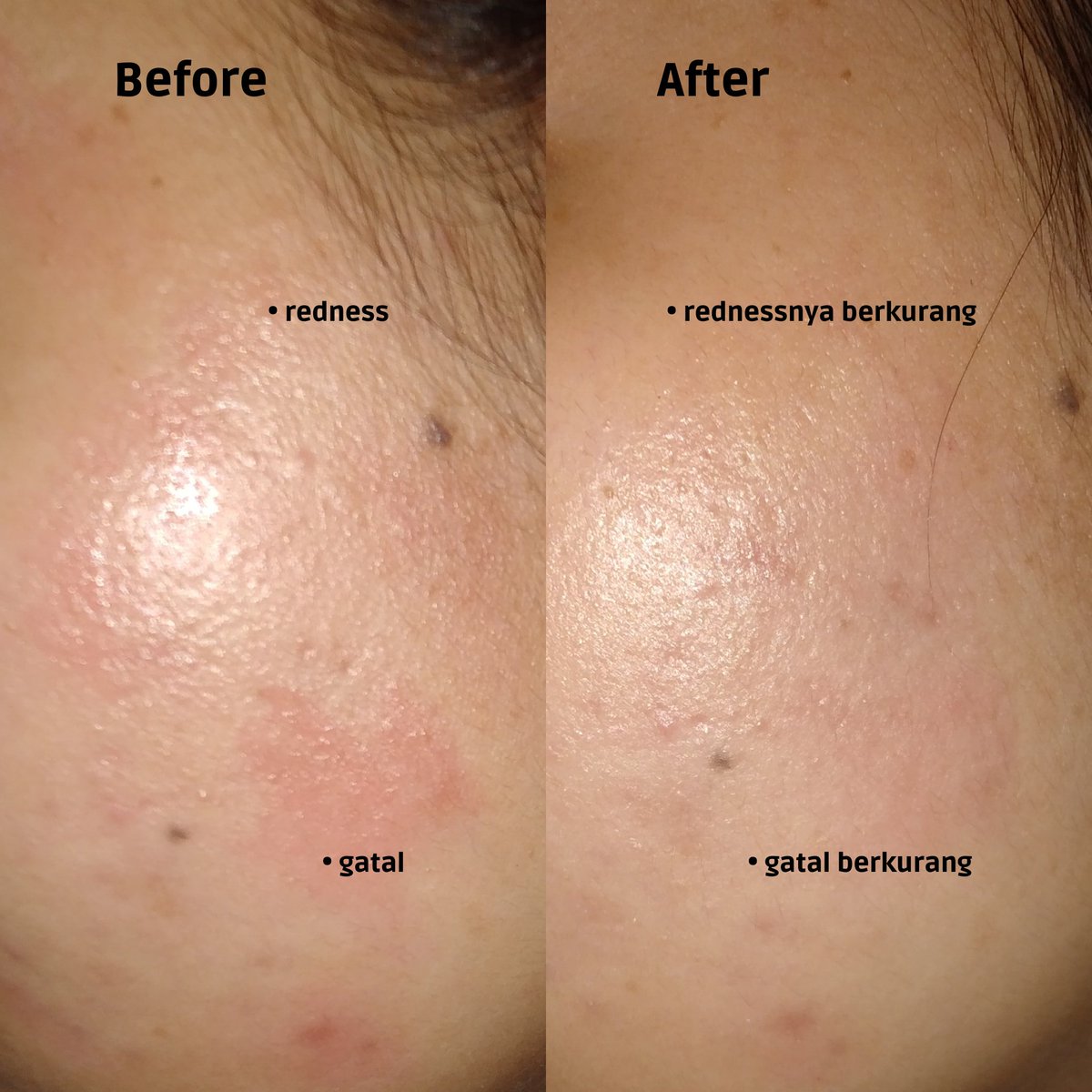 bulbulkun's tweet photo. Definisi moisturizer VERSATILE! Bisa dipake kapanpun dan dalam kondisi apapun~🥹❤️

Aku paling suka pake ini kalo kulit lagi ngamuk banyak redness. Dijamin better banget😆👌
Dipake barengan Retinol - Exfoliant juga cakep udah kaya 'bestie', calmingnya ada banget🫰
Coba tebak!😗 https://t.co/oIcr10vWW1