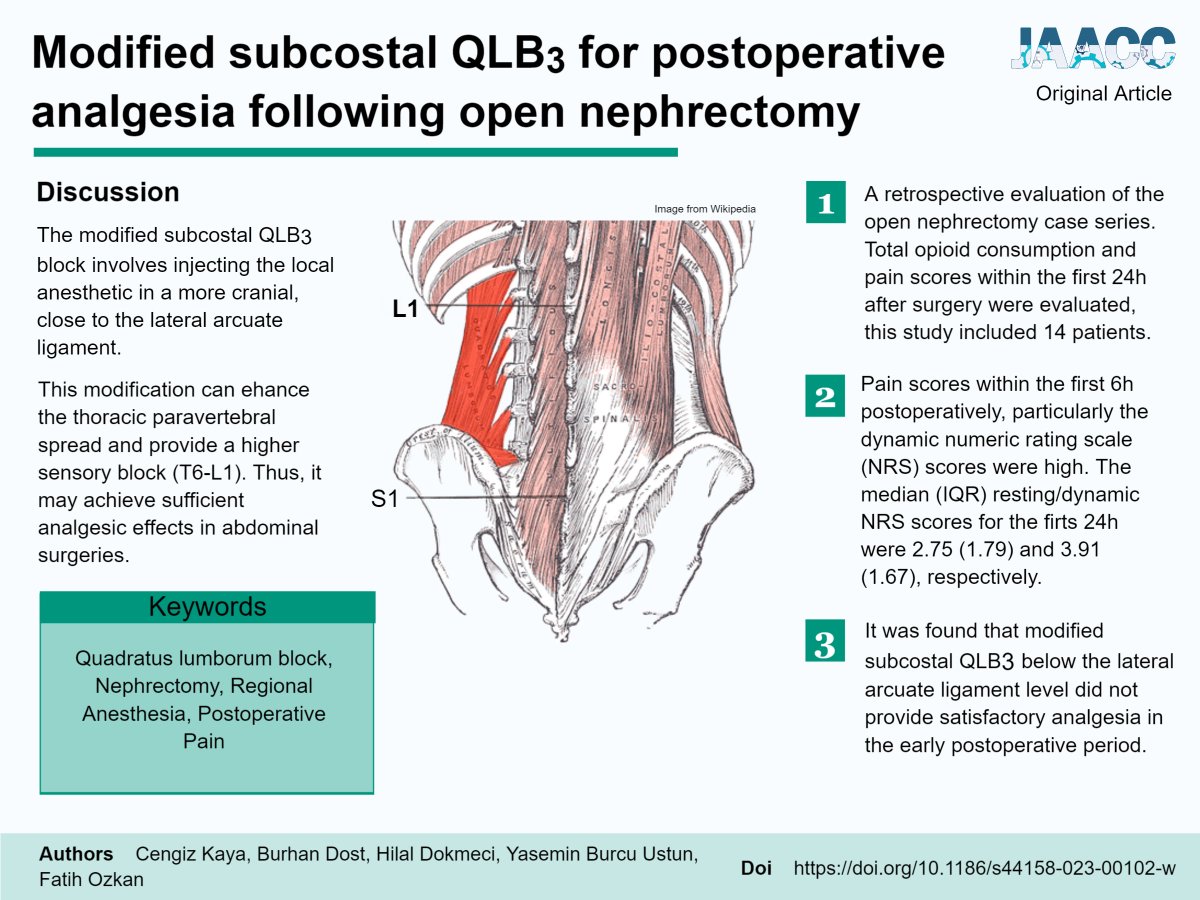 💉The modified subcostal #QLB3 #block involves #injecting the #Local #anesthetic in a more cranial, close to the lateral arcuate ligament
👉 janesthanalgcritcare.biomedcentral.com/articles/10.11…

#Quadratuslumborumblock #Nephrectomy #RegionalAnesthesia #Postoperative #Pain #ALR #FOAMed #FOAMcc @jaacc_online