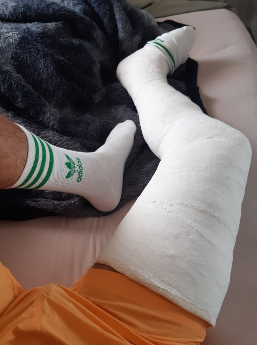 caster_well's tweet photo. A cast to remember #castfetish #plastercast #llc #llccast #longlegcast #peengessado #pernaengessada #engessado #feet #malefeet #gayfeet https://t.co/GYnydkiZhX
