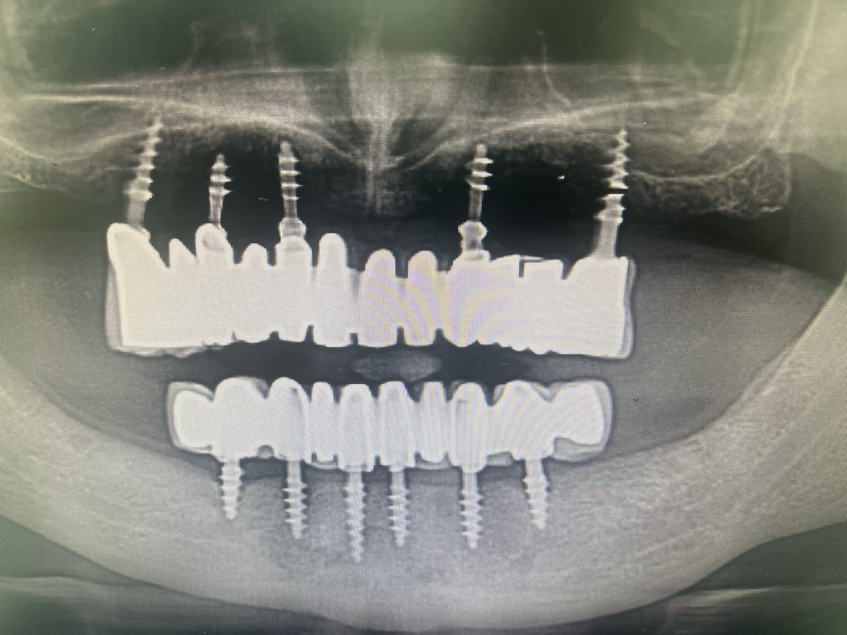 dentist_emotion's tweet photo. وتستمر المعاناة بشكل شبه يومي 🫣 https://t.co/1kqPSPth9R