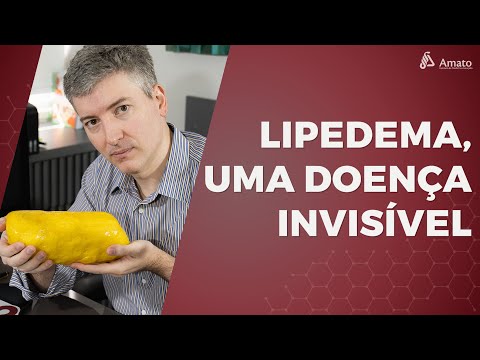 AmatoClinic's tweet photo. 🚨Lipedema: conheça essa doença invisível que afeta milhões de mulheres! O Instituto Amato acaba de publicar um vídeo esclarecedor para você entender melhor. Assista agora ▶️https://t.co/A3hVuCJY5Q e informe-se! 💡 #lipedema #saúde #InstitutoAmato https://t.co/q1MiG3rtDc