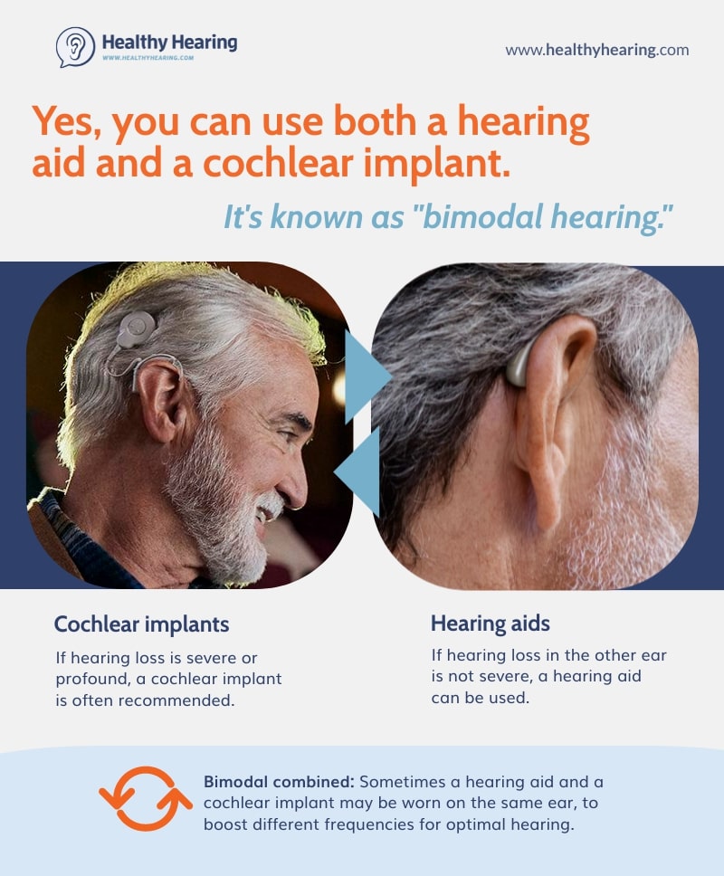 Can I wear a cochlear implant in one ear and a hearing aid in the other? ow.ly/AYIF50ORVWF