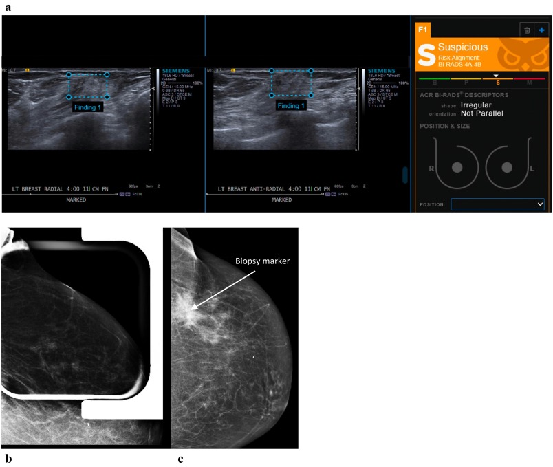 Weill Cornell Medicine Radiology (@wcmradiology) on Twitter photo In <a href="/CI_Journal/">Clinical Imaging</a>, <a href="/KristenCoffeyMD/">Kristen Coffey</a> takes on #BreastCancer by evaluating #AI + #ultrasound. sciencedirect.com/science/articl… In <a href="/CI_Journal/">Clinical Imaging</a>, <a href="/KristenCoffeyMD/">Kristen Coffey</a> takes on #BreastCancer by evaluating #AI + #ultrasound. sciencedirect.com/science/articl…