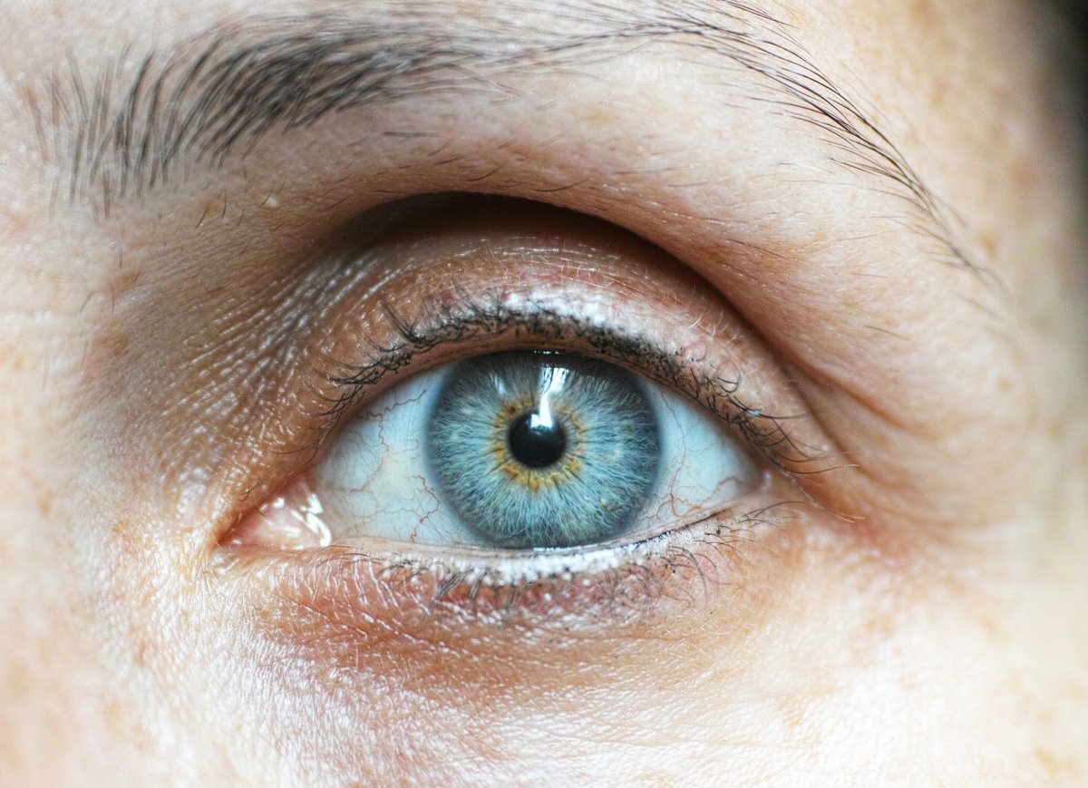June is Cataract Awareness Month! Curious how cataract surgery works? Check out this short animation on YouTube: bit.ly/1JiCZRp.

#eyehealth #vision #CataractAwarenessMonth #cataractsurgery <a href="/AcademyEyeSmart/">EyeSmart</a>