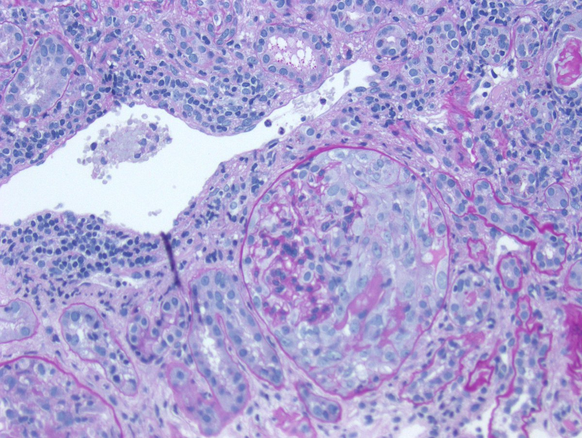 Kuang-Yu Jen, MD, PhD tweet media