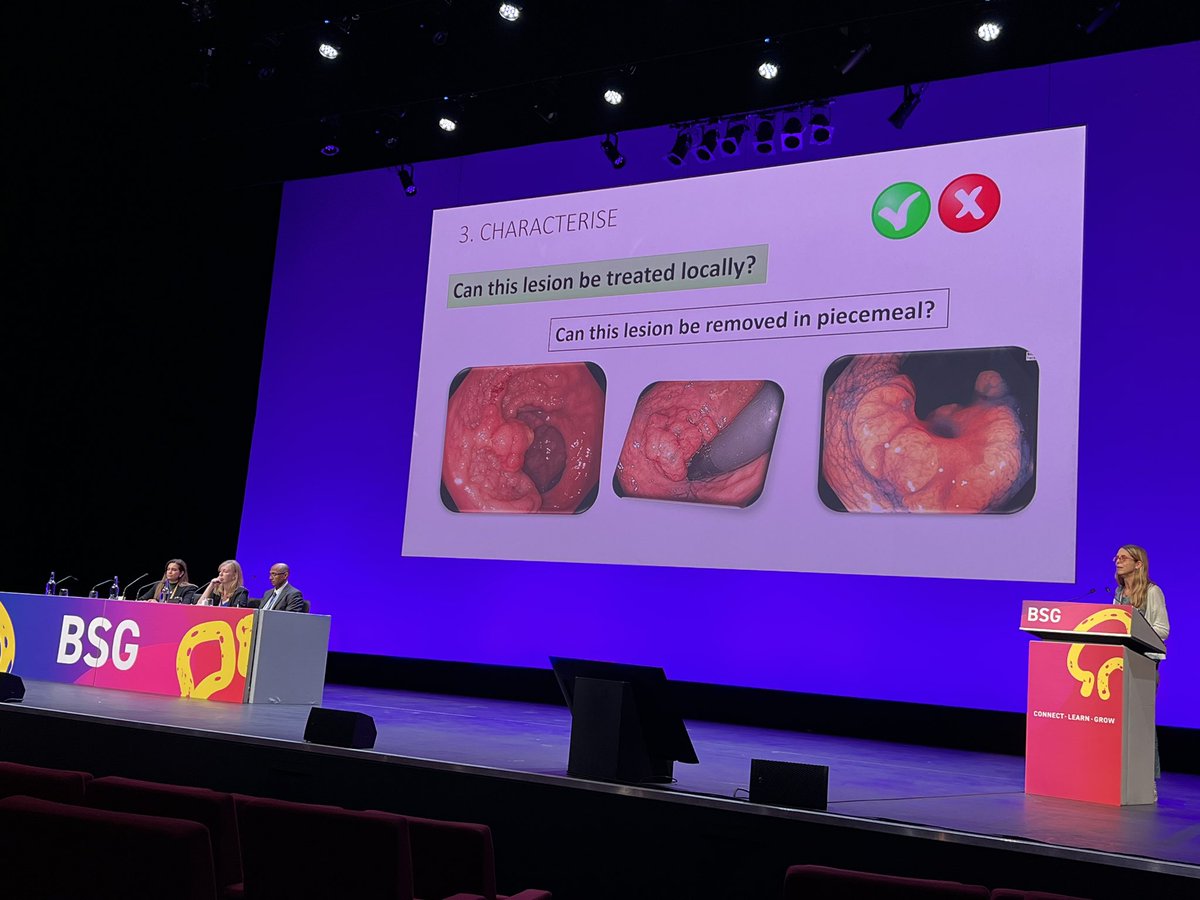 ttham1's tweet image. Practical tips on #polypectomy, recognise if it can be resected endoscopically , masterclass from @mariapellise1 at #esgeatbsg #BSGLIVE23 #Liverpool