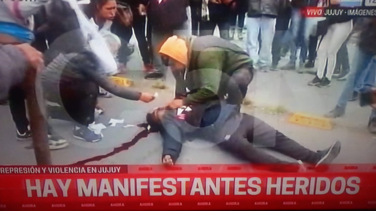 vaninabiasi's tweet photo. El herido es Nelson Mamani. Acaba de entrar al quirófano. Milita en el MAR, integrante del Frente de Lucha Piquetero. La policía de Morales le disparó directo a la cabeza con un tubo de gas lacrimógeno. Así mataron a Carlos Fuentealba. 
Abajo Morales y su reforma reaccionaria. https://t.co/lPez12nyS8