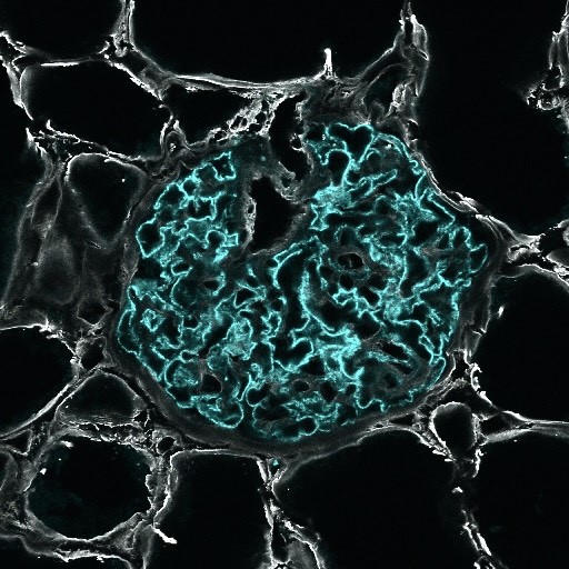 Our podocyte BioID paper is now published! We generated a BioID knock-in mouse to acquire the localized proteome of podocin in vivo. I did a tweetorial of the preprint, here's a link to the updated manuscript:  frontiersin.org/articles/10.33…