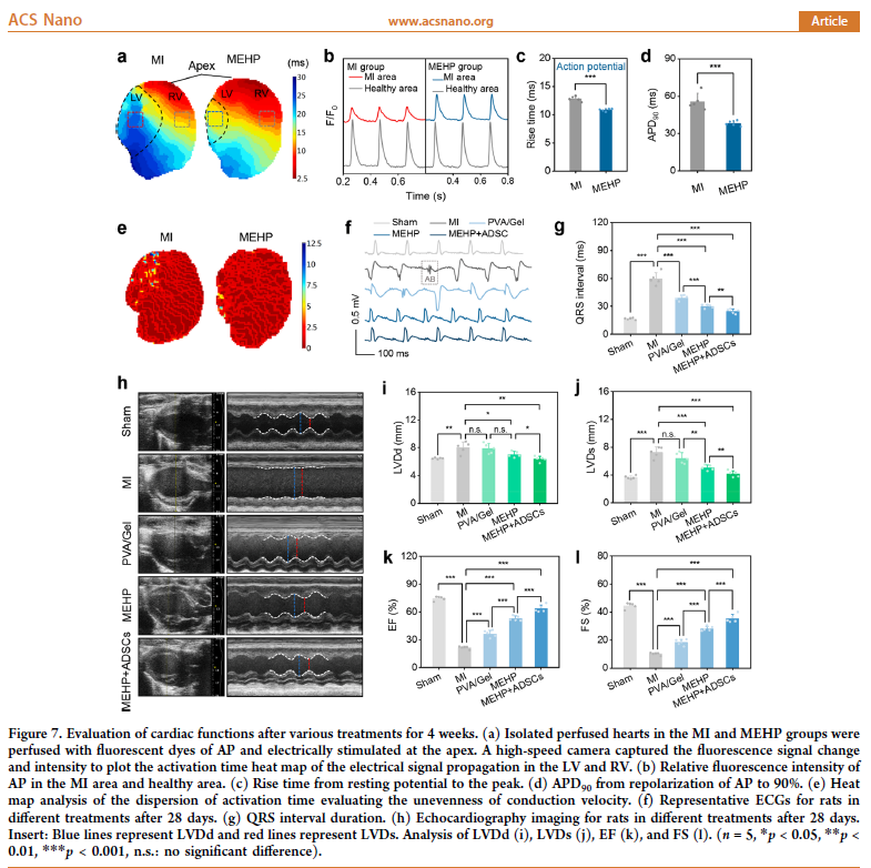 MappingLab_EP's tweet photo. Yu et al (2023) showed an injectable MEHP combined with cell therapy effectively prevents ventricular fibrosis & remodeling, promotes neovascularization & restores electrical propagation & synchronized pulsation, facilitating the clinical translation of cardiac tissue engineering https://t.co/0if9Ee8x2g