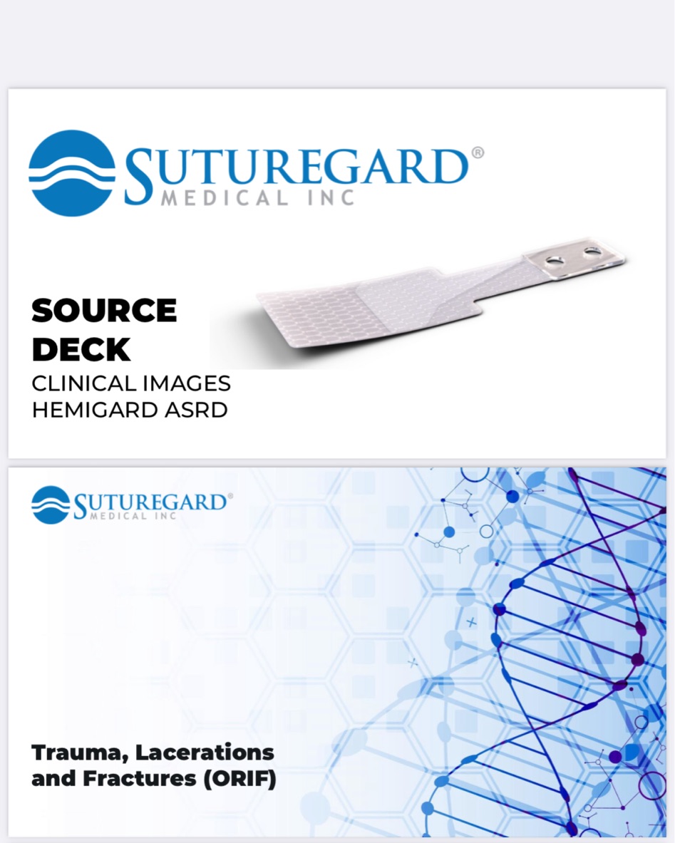 Check out our new “look book” of HEMIGARD surgical cases at zurl.co/aSUz