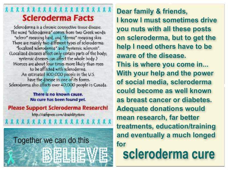 kassbenson1's tweet image. June is #SclerodermaAwarenessMonth. 
Diagnosed in 2011 - still pressing!!