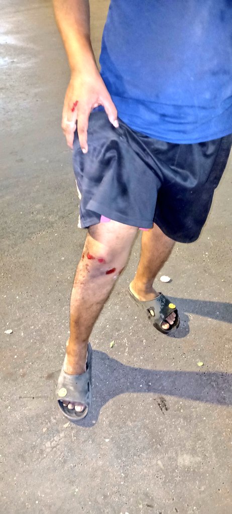 NIKHILCHHEDA6's tweet photo. I Request To @mybmc @mybmcWardHW @mybmcRoads @MCGM_BMC That Please Paint This Newly Made Speed Breakers At PM Road Santacruz West It's Not Visible To Pedistrains &amp; Two And Four wheelers. Yesterday Only One Two Wheeler Got Injured Plz Look Into This Matter And quickly Resolve it. https://t.co/2dEe2qzH9k
