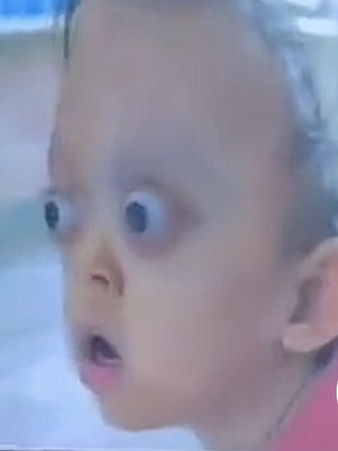 Fugoe🥸 tweet media