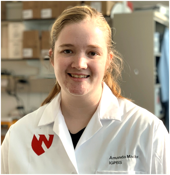 UNMC Biochemistry and Molecular Biology (@unmc_biochem) on Twitter photo Congratulations to Petrosyan’s
<a href="/armpetr/">Armen Petrosyan</a>
lab on publishing manuscript “Targeting the ATF6-mediated ER stress response and autophagy blocks integrin-driven prostate cancer progression” in Molecular Cancer Research
<a href="/MCR_AACR/">Molecular Cancer Research</a> aacrjournals.org/mcr/article-ab…
Amanda Macke is the first-author Congratulations to Petrosyan’s
<a href="/armpetr/">Armen Petrosyan</a>
lab on publishing manuscript “Targeting the ATF6-mediated ER stress response and autophagy blocks integrin-driven prostate cancer progression” in Molecular Cancer Research
<a href="/MCR_AACR/">Molecular Cancer Research</a> aacrjournals.org/mcr/article-ab…
Amanda Macke is the first-author