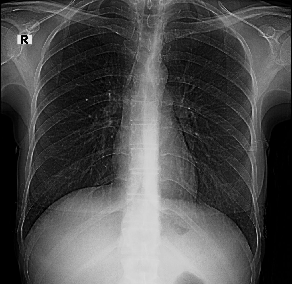 radRounds Radiology Network tweet media