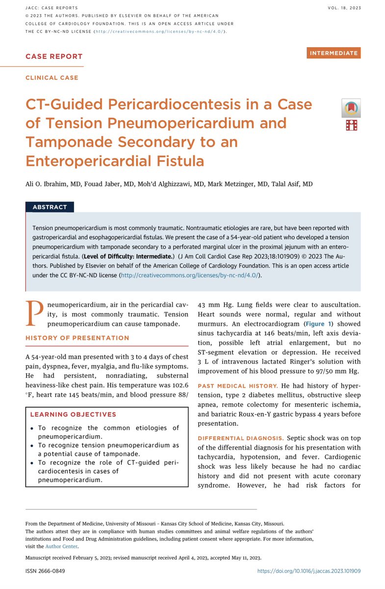 fouadsjaber's tweet photo. 🚨 New Publication 🚨

The Way to a Man's Heart Is through His Stomach 😋 
▶️ Enjoy this interesting case: 
CT-Guided Pericardiocentesis in a Case of Tension Pneumopericardium and Tamponade Secondary to an Enteropericardial Fistula 

🎉Published at Journal of Ameican College of Cardiology ( JACC: case reports @JACCJournals ) 

 🔀 Read here ⤵️

https://t.co/ezzgIU3deo

🎯Entero-pericardial fistula can occur as a delayed complication of Roux-en-Y gastric bypass. 
🎯Although uncommon, fistulous or nontraumatic tension pneumopericardium should be considered in cases of cardiac tamponade. 
🎯CT-guided pericardiocentesis can be used in cases where echocardiography is limited by air artifact.

Great working with this team: @Ali_O_Ibrahim, @umkcIM
 #MedEd #jacc