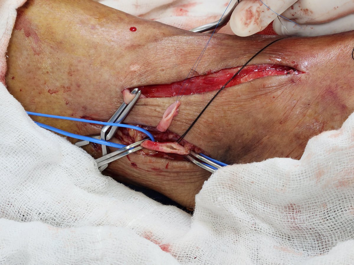 Necio Lizola MD tweet media