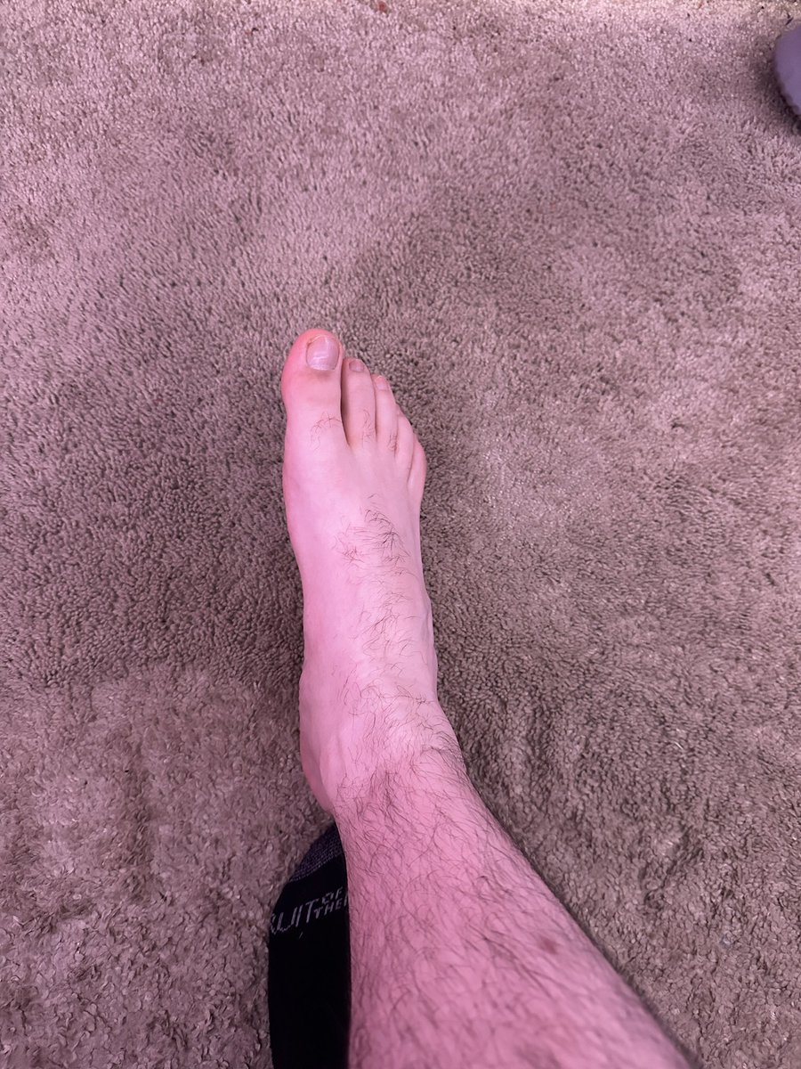 "PEEPS"/AGB Charity tweet media