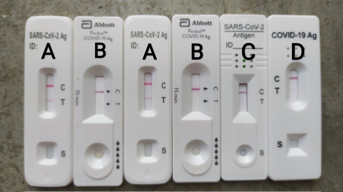 This is the anedoctal tale of six rapid antigen covid tests (RAT) from four different brands taken by the same person, within a 2 hour time period and how the results were quite diverse. It reinforces that a negative RAT doesn't mean a person isn't infected. Act accordingly.
1/