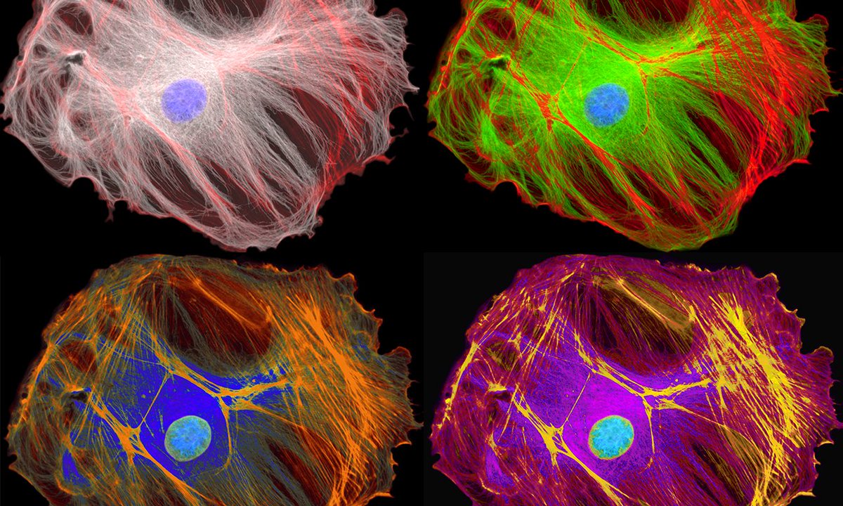 CellScience4's tweet image. #Cytoskeleton #microtubules #filaments #motor #proteins #kinesin