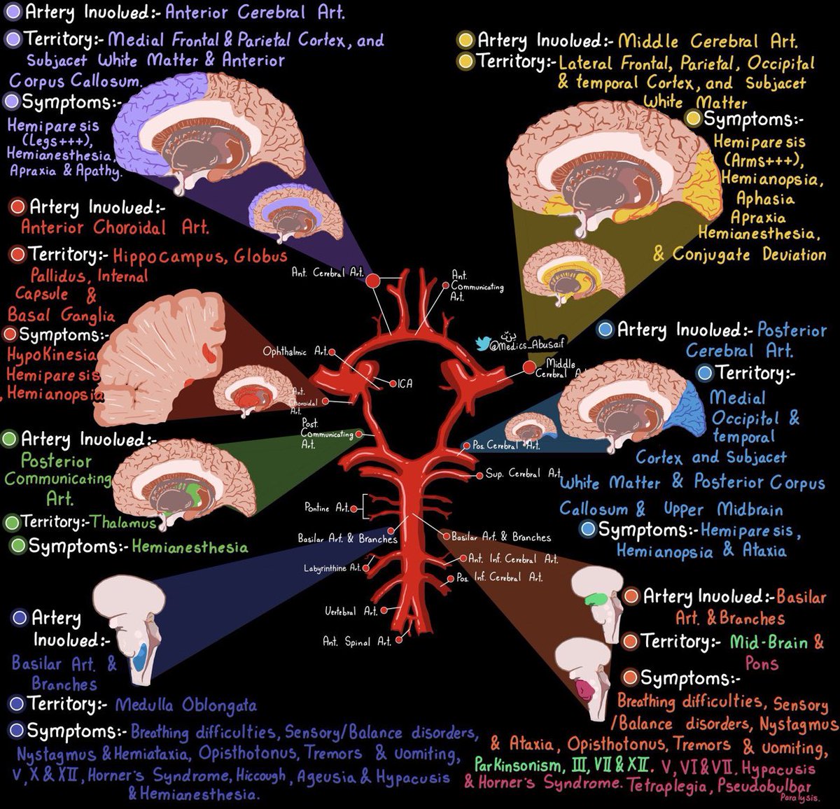 An illustration of stroke presentations by the awesome