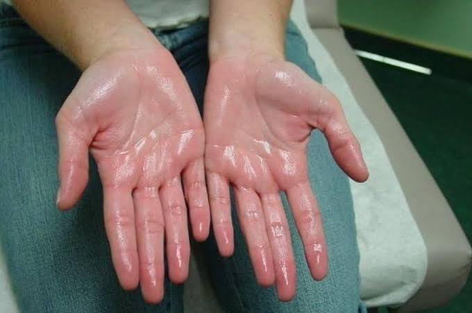“Telapak tangan keringetan terus tuh tanda jantung lemah/paru2 basah!”

MITOS! 👹
Kondisi telapak tangan sering basah kayak gitu disebut hiperhidrosis.
Nah, kondisi ini sebenarnya ga berhubungan dg aktivitas fisik atau pun suhu udara. Harusnya sih ga berbahaya, tapi…