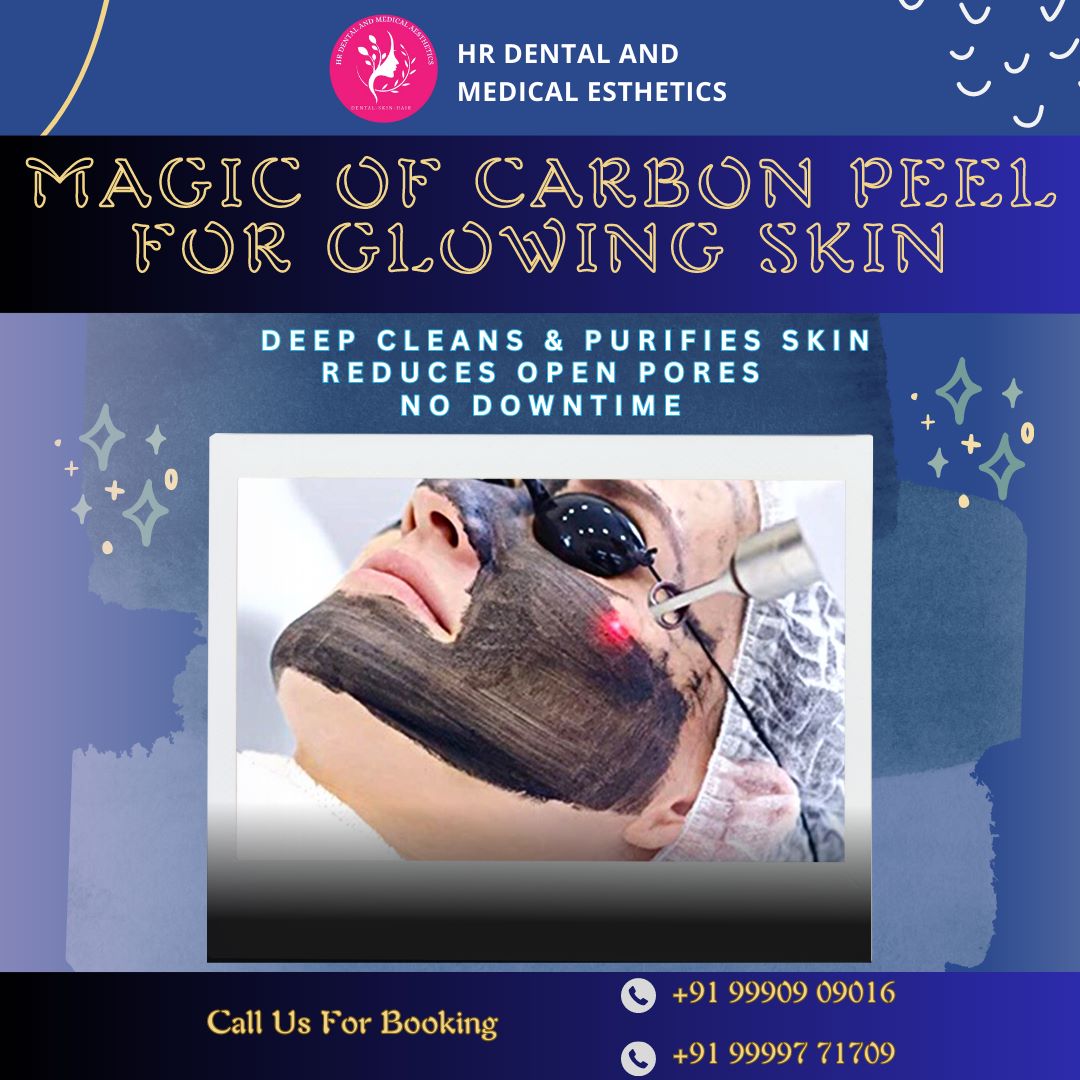 Elevate your skincare routine with the magical touch of Carbon Peel at HR Dental And Medical Aesthetics.  
For bookings, call Dr. Himani Bhardwaj at +91 99997 71709 or visit our clinic at SB 34, Shashtri Nagar, Ghaziabad.
#CarbonPeel #GlowingSkin #MagicPeel #hrdentalcare #skin
