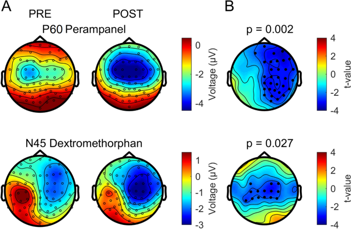 #rTMS and #BipolarDepression:  Predicting #Clinical #Response
Read more: rb.gy/c302q
#Clinicalpsychiatry
#TPCTJ
#research 
#manuscript