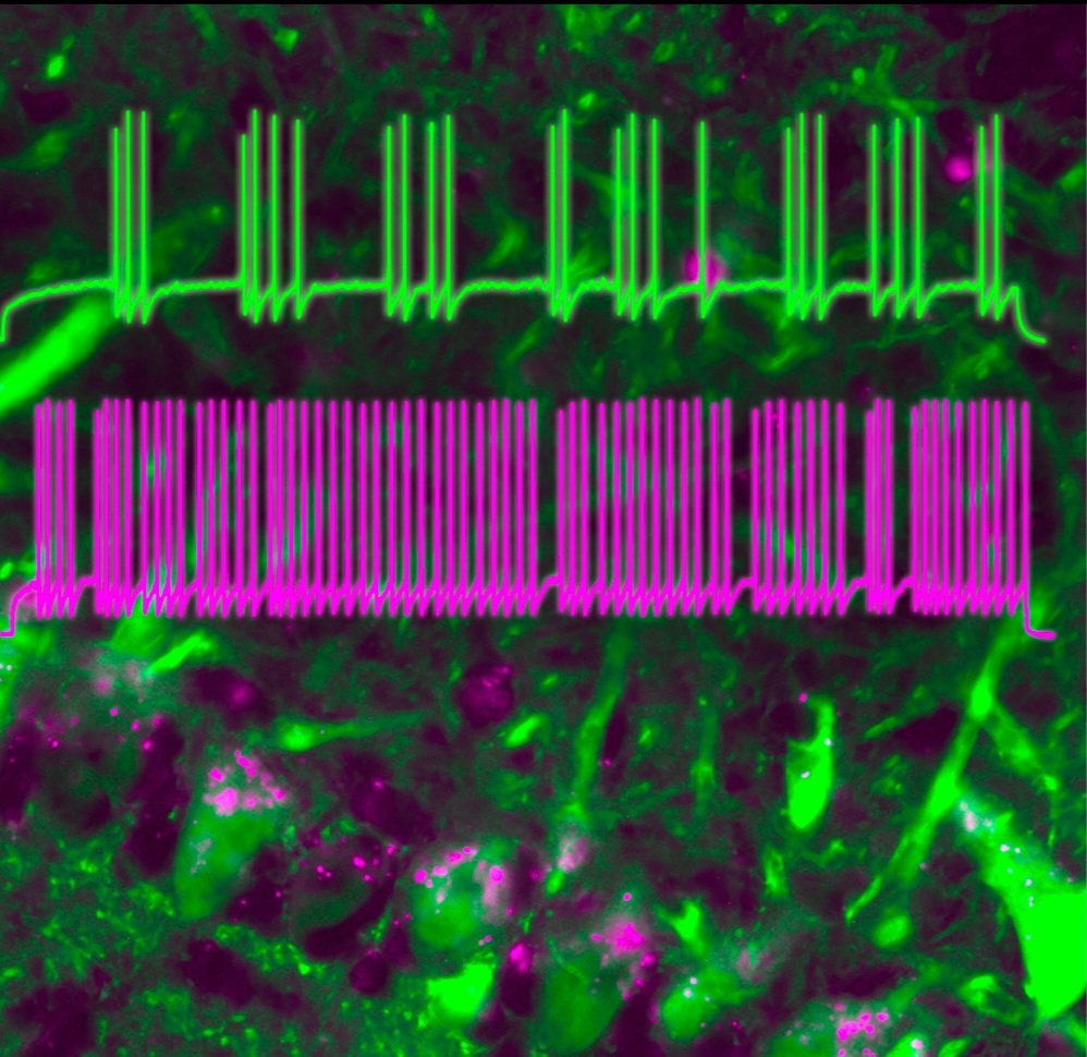 Interested in intersection of obesity, olfaction, & neural circuitry?  Mentored #postdoc position & skill training - brain slice, nanoparticle/viral deliv, metabolism, CRISPR, light sheet, olfactometry - Come join our team!! See NeuroJobs & dfadool.neuro.fsu.edu
@AchemsInfo