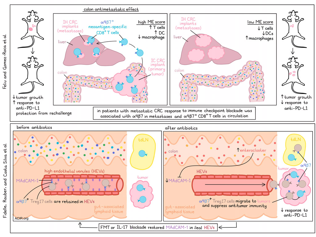 ACIR (@acir_org) on Twitter photo New immune checkpoint affected by the gut #microbiome involved in lack of #immunotherapy responses in colon cancer. Read our double feature here: bit.ly/3NDvawe <a href="/FeliuVirginie/">Virginie Feliu</a>Â <a href="/ChristelDevaud/">Devaud Christel</a> <a href="/TeamT2i/">AYYOUB LAB</a> Â <a href="/GustaveRoussy/">Gustave Roussy</a> Â <a href="/CarolinaAlvesC5/">Carolina Alves Costa Silva, MD, PhD</a> Â <a href="/derosa__lisa/">lisaderosa</a> #CRCSM New immune checkpoint affected by the gut #microbiome involved in lack of #immunotherapy responses in colon cancer. Read our double feature here: bit.ly/3NDvawe <a href="/FeliuVirginie/">Virginie Feliu</a>Â <a href="/ChristelDevaud/">Devaud Christel</a> <a href="/TeamT2i/">AYYOUB LAB</a> Â <a href="/GustaveRoussy/">Gustave Roussy</a> Â <a href="/CarolinaAlvesC5/">Carolina Alves Costa Silva, MD, PhD</a> Â <a href="/derosa__lisa/">lisaderosa</a> #CRCSM