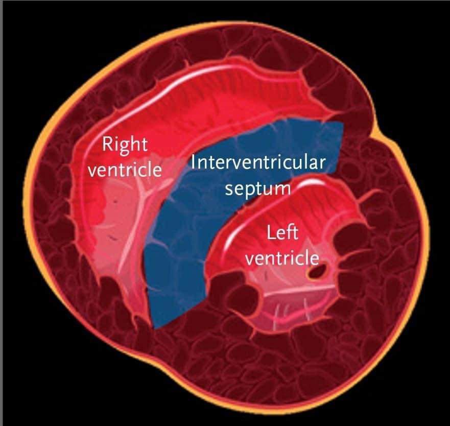 LeslieMegom's tweet photo. ➡️📌Ultrasonografía cardíaca  del ventrículo derecho y la función sistólica🫀
💥 Puntos  importantes para la valoración  del VD
👇🏻👇🏻👇🏻👇🏻👇🏻
https://t.co/xVfWNjYRFG
🗝🔓https://t.co/uubimFUFmb https://t.co/6DdaOjYuyI