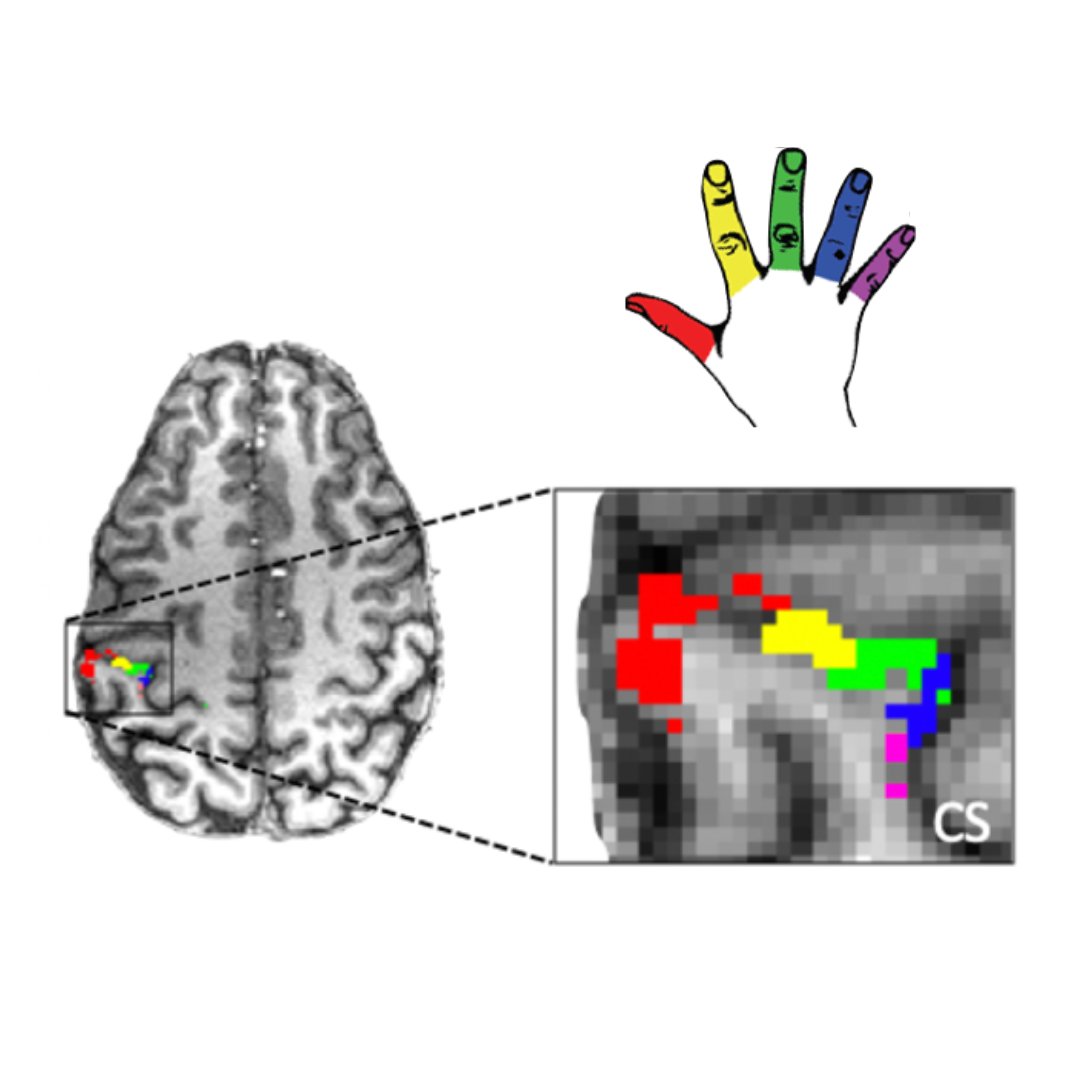 Plasticity Lab (@plasticity_lab) on Twitter photo Postdoc opportunity: Plasticity Lab <a href="/mrccbu/">MRC Cognition and Brain Sciences Unit</a> <a href="/Cambridge_Uni/">Cambridge University</a>. Explore motor control & advanced neuroimaging to unravel the neural underpinnings of hand function. Develop innovative ways to enhance hand functionality using technology for all abilities & ages tinyurl.com/2s494nb7 Postdoc opportunity: Plasticity Lab <a href="/mrccbu/">MRC Cognition and Brain Sciences Unit</a> <a href="/Cambridge_Uni/">Cambridge University</a>. Explore motor control & advanced neuroimaging to unravel the neural underpinnings of hand function. Develop innovative ways to enhance hand functionality using technology for all abilities & ages tinyurl.com/2s494nb7