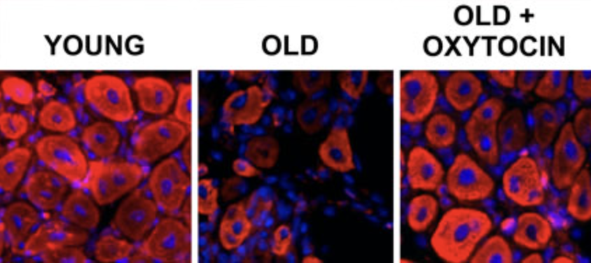 Oxytocin improves the health of your cardiovascular system by reducing:

→Inflammation
→Plaque formation
→Sympathetic activity
→Vascular oxidative stress