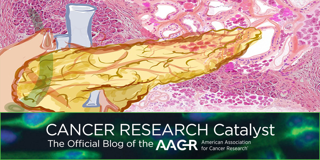 AACR (@aacr) on Twitter photo The pancreatic microenvironment may contribute to cancer onset and spread, according to research published in <a href="/CD_AACR/">Cancer Discovery</a> and presented at #AACRras23. Learn more on the #AACRBlog: bit.ly/3JnsvEp <a href="/umichmedicine/">Michigan Medicine</a> The pancreatic microenvironment may contribute to cancer onset and spread, according to research published in <a href="/CD_AACR/">Cancer Discovery</a> and presented at #AACRras23. Learn more on the #AACRBlog: bit.ly/3JnsvEp <a href="/umichmedicine/">Michigan Medicine</a>