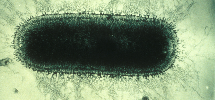 It's time for #MicrobeoftheMonth! Can you guess who I am?

1. I exist on every continent except Antarctica.
2. I infect the central nervous system.
3. The disease I cause is virtually 100% fatal once clinical symptoms appear.

Know the answer? Comment your guess below!