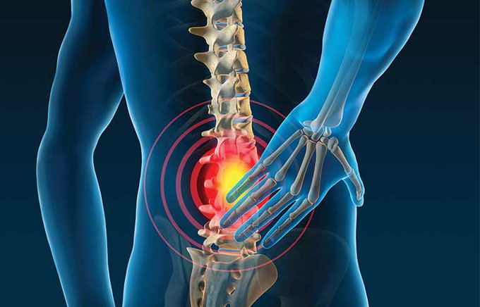 ChamberofFit's tweet image. At age 16 I was diagnosed with a herniated disc in my lower back.

Years of back pain &amp;amp; right foot numbness followed.

Now at 30 I'm symptom free.

Here are 5 exercises that have helped eliminate my pain &amp;amp; strengthen my back: