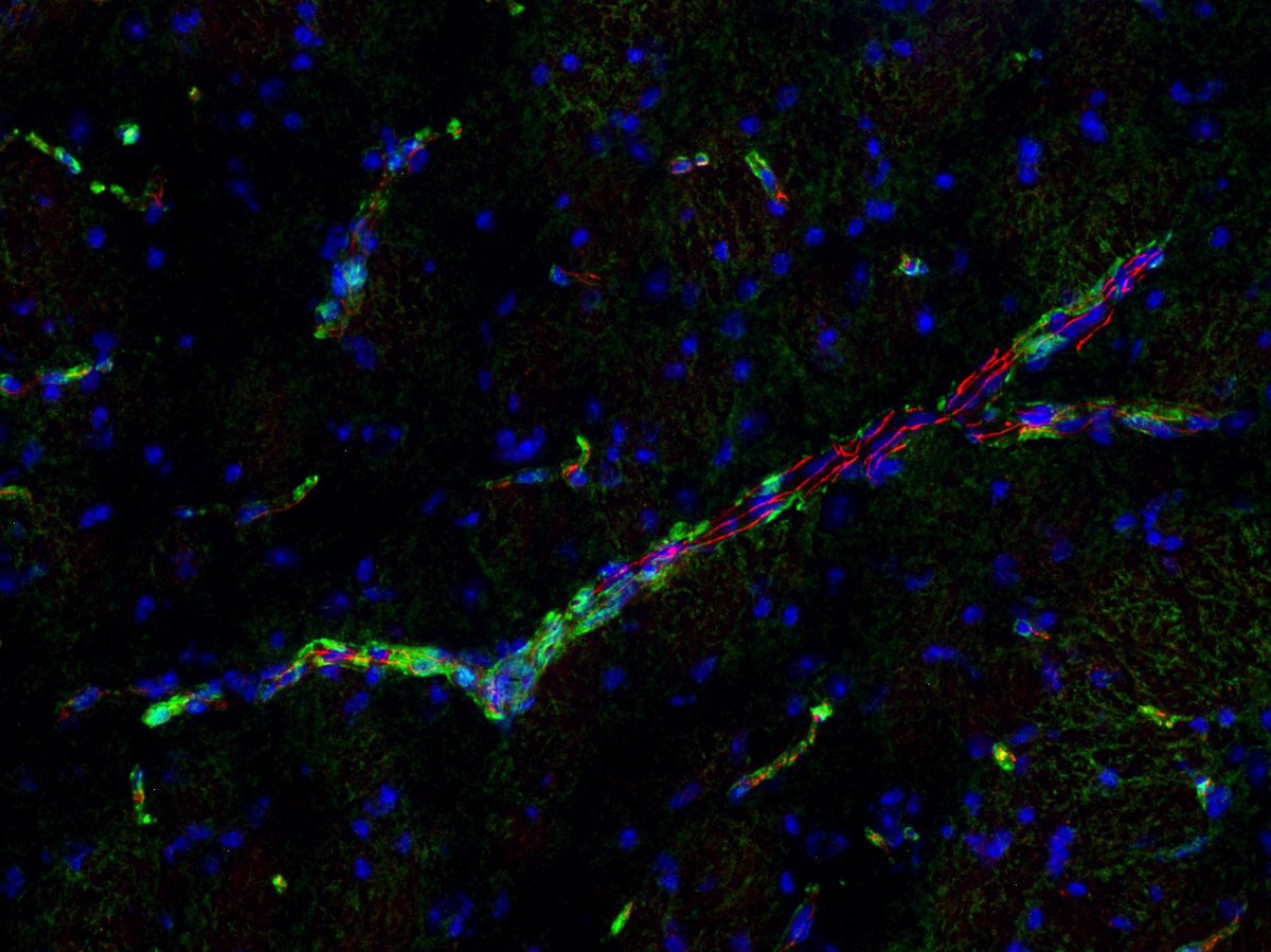 Indirect immunostaining of methanol postfixed mouse brain fresh frozen section with guinea pig anti-Tight junction protein ZO-1 antibody (red) and mouse anti-Aquaporin 4 antibody (green). Nuclei have been visualized by DAPI staining (blue). #endothelialcell
