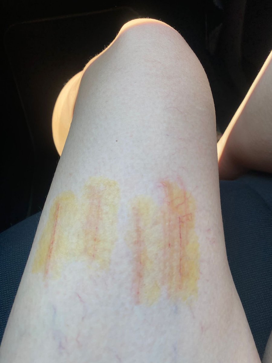 CesAsCK's tweet image. #RixosMoments I was at the Rixos Beldibi 2 days ago and we didn&apos;t.3. Or the facility, which we came to for the 4th time, disappointed me this time. While leaving the sea my wife entered from the pier, the ship of the fast oncoming wave broke up