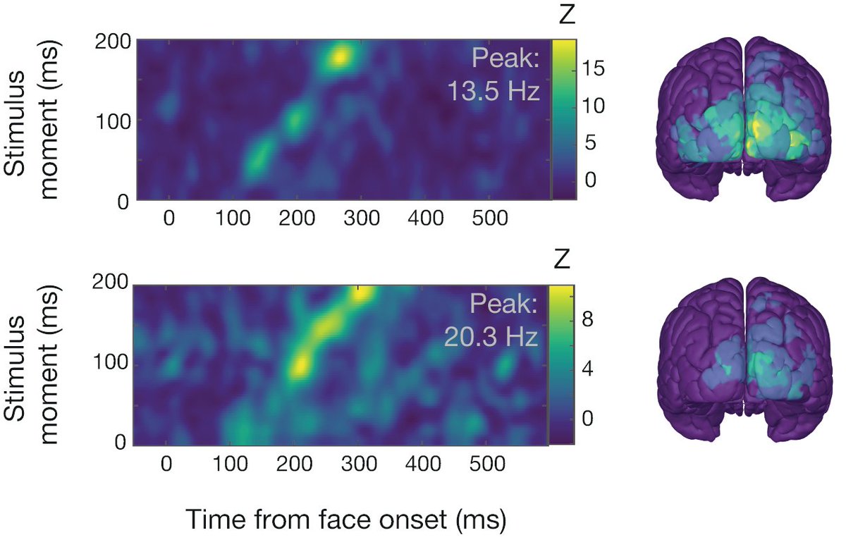 Our paper "Rhythmic information sampling in the brain during visual recognition" is now published in Journal of Neuroscience!t.ly/t6cj We observed rhythmic sampling across stimulus time in the brain and disentangled it from more typical rhythmic processing. 🧵👇1/10