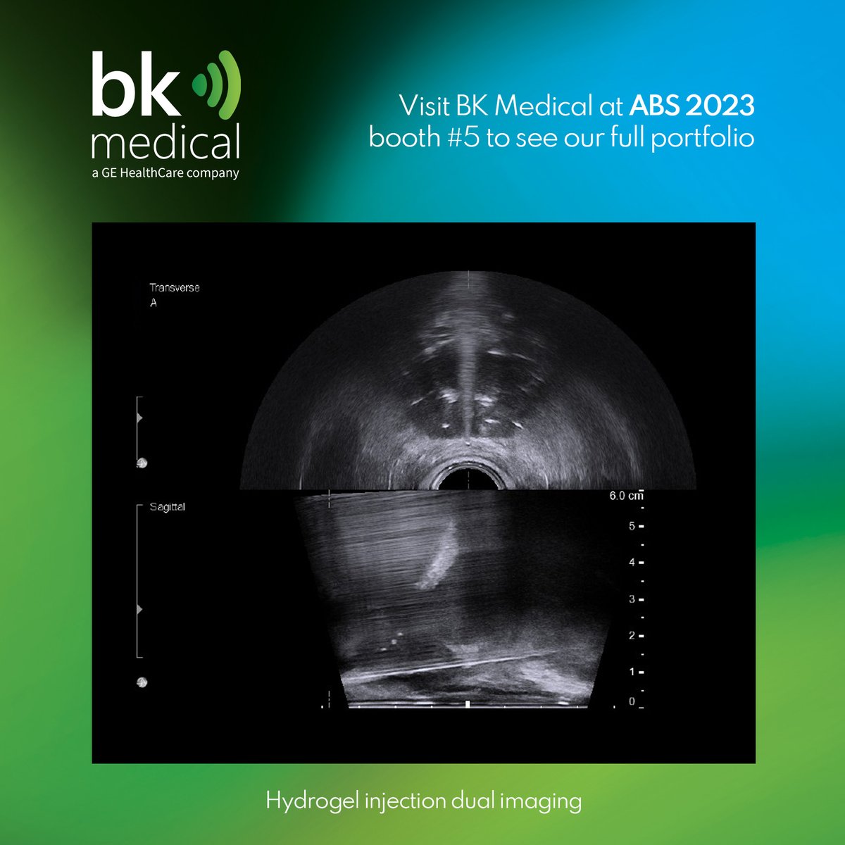 bk_Medical's tweet photo. Visit BK Medical at #ABS2023 Booth #5 to see our full portfolio of ultrasound solutions and accessories for guiding brachytherapy, biopsies and rectal spacer placement. 
Found out more: https://t.co/9KyXmnNxbA https://t.co/IlTql39tTe