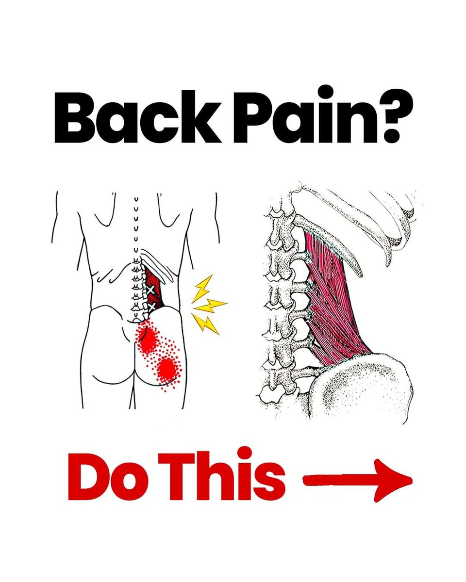 The_Life_Pad's tweet image. Back pain Open this...