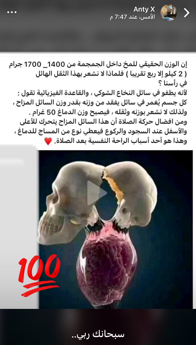 Znejo's tweet photo. @dalangary سبحانك ربي ي دلال أثبتت دراسات علمية مرفق صورة منها أن الدماغ يزيد فيه نسبة الاكسجين فما بالك بذكر الله فيه وأنت ساجد ؟! هل يصبح الأنسان ذو يقين أن أقداره موكلة بيد خالق عظيم . (حالة خالتي الجميلة fato ولدت قبلي بشهرين وهي أعلم مني بدهرين) https://t.co/1BGC8ywNwW